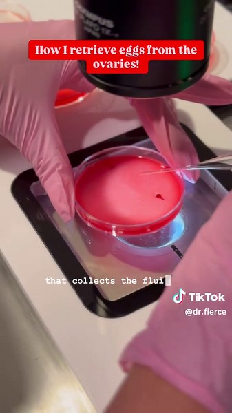 Understanding Egg Retrieval Techniques and Process