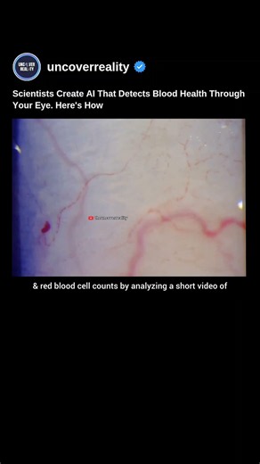 Scientists Created AI That Detects Blood Health Through Your Eye. Here's How #ai #shorts #health