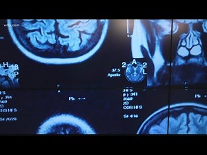 Dye used in certain medical scans is in short supply: What that means for South Carolina hospitals