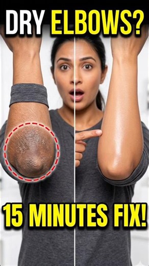 Smooth Elbows in 15 Minutes! ✨#skincare #shortvideo