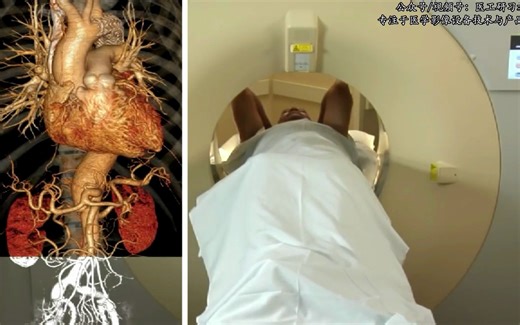 高速运行的CT工作状态，太震撼了