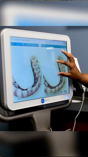 Ever look in the mirror and think, “I just don’t like my smile”? You’re not alone. At Robinson Dental, we create personalized treatment plans—whitening, Invisalign, veneers, or simple touch-ups—to help you feel confident again. When you love your smile, everything changes. 💙✨ | Robinson Dental