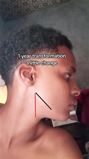 One Year Transformation: Embracing Change