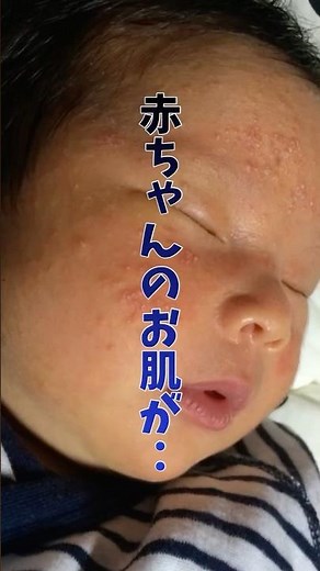 正しい保湿剤の塗り方🧴
