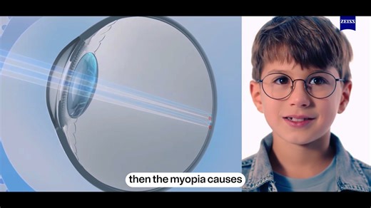 393 reactions · 21 shares | What is myopia? Why does it happen? And...