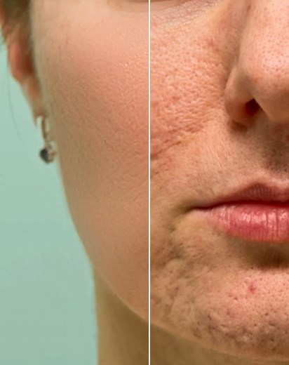 How to make skin retouching in Adobe Photoshop Tutorial #photoshop | RG Graphic