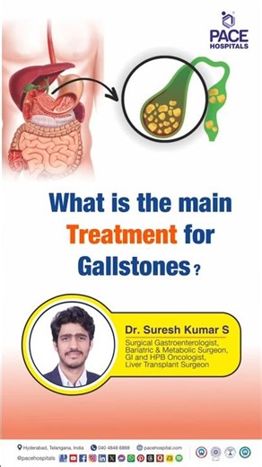 What are the Treatments for Gallstones? | Gallbladder Stone Management #gallbladderstone