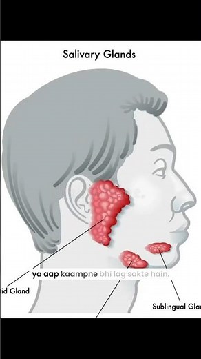 Dry Mouth Treatment