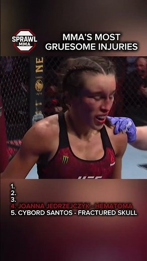 MMA’s Most Gruesome Injuries 😱