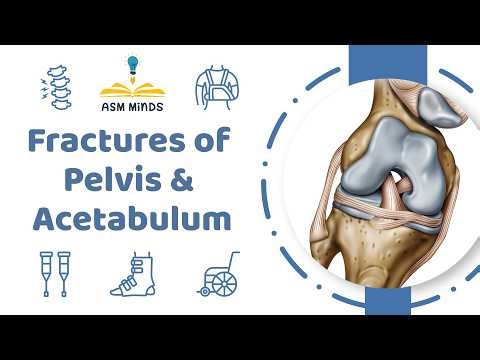 18 - Fractures of Pelvis & Acetabulum - Orthopedics Course - By Dr.Sofy Said