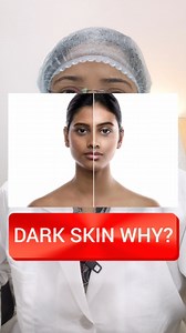 OJAS by Dr.Shaista Khan on Instagram: "Dark Skin Why🥺🥺🥺 I Hope you like the vide♥️ Keep watching for more beauty tips & health tips♥️ #reels #instagram #viralreels #skin #hair #health #ojas #hho #drshaistakhan #ojasclinic Disclaimer: Using my video or my content without my permission is an offence. You cannot share it on your Instagram, YouTube channel, Twitter, Facebook or any other social media platforms. Any information on diseases and treatment available on this video are educational and 