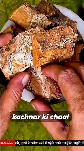 Home Remedy to Shrink Lipoma | Ayurvedic Treatment for Lipoma | Lipoma Treatment Without Surgery