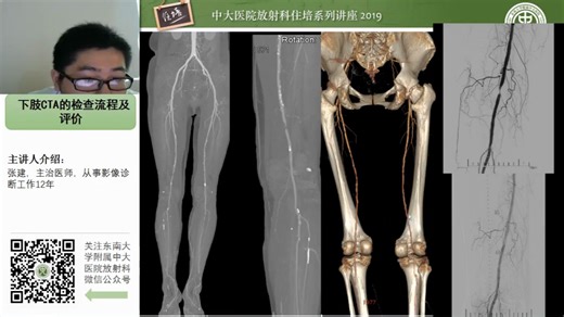 下肢CTA的检查流程及评价-中大张健