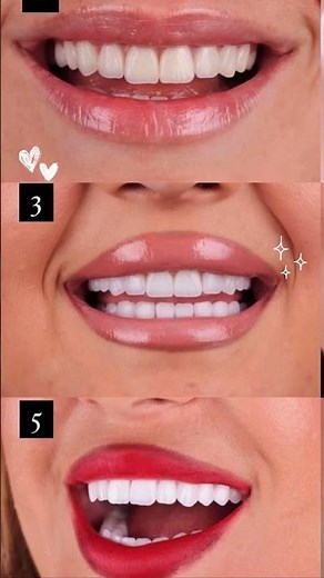 AESTHETIC DENTISTRY BY DR. PETRIT ADEMI