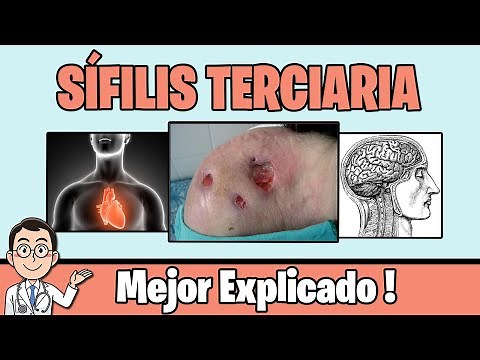 SÍFILIS TERCIARIA: GOMA SIFILÍTICO, NEUROSÍFILIS Y SÍFILIS CARDIOVASCULAR | CLINICA