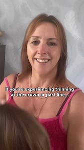 Here’s the solution 👇 ✅ Undetectable coverage that blends with your bio hair ✅ Easy styling—wear it straight, curled, or up in a ponytail Comment “TOPPER” for a personalized match! 💌 ___________ 🤎 Hair topper: Upgrade Aura in 505R Light Mousse Brown, 14’’. 🔗 Shop via the link in our bio, or search “PS2309” at www.uniwigs.com . . . . #UniWigs #FemaleHairLoss #Alopecia #Over40Beauty #AutumnHair #HairLoss #MidLifestyle #HairToppers #ThinningHairSolution #AndrogenicAlopecia #AlopeciaAwareness | 