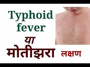 Typhoid investigation | enteric fever and causes and treatment