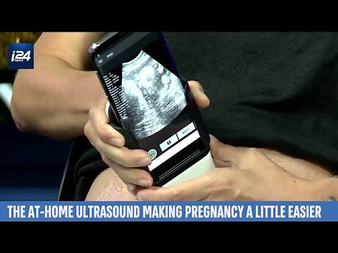 At-Home Ultrasound Lets Pregnant Mothers Monitor Babies by Smartphone