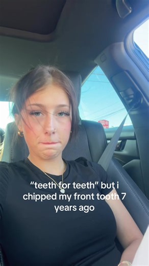 #fyp #trending #fy #teeth #repost | teeth for teeth