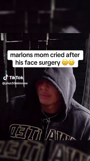 Marlon's Emotional Transformation After Surgery