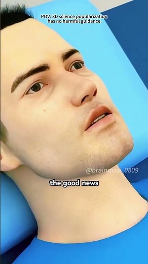 Thyroid Gland Removal Surgery (3D Aniamtion)