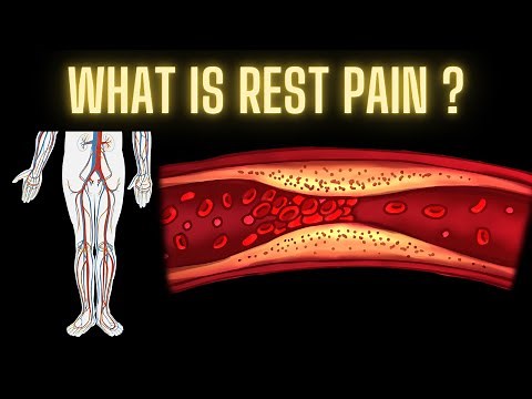 What is rest pain ? Explaining PAD and how it differs from traditional sciatica