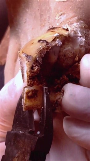 5.4K views · 32 reactions | How to cut nails #nails #nail #nailart #nailpolish #nailswag #nailstagram #naildesign | Dron Nails | Facebook