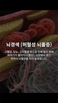 01 뇌졸중의 두 얼굴 뇌경색과 뇌출혈 #뇌졸중 #뇌경색 #뇌출혈