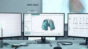 Using Respiratory Scan Software In Medical Lab To Diagnose Covid-19 Disease. Human Respiratory System Scan Finds Epidemic Virus Disease. Scanning Respiratory Organ Affected By Dangerous Disease