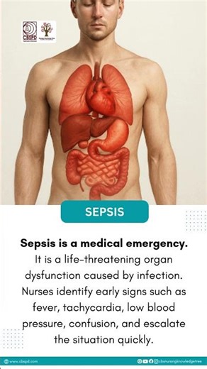 The 4 Early Signs of SEPSIS EVERY NURSE Must Know! (Critical Care Nursing Facts) | CBS