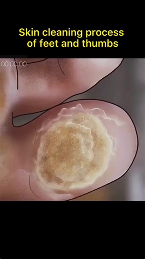 El proceso de limpieza dental y ortodoncia