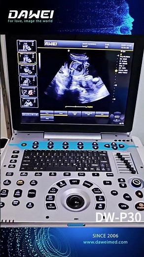 Witness the First Pulse of Life | Fetal Heart Ultrasound Imaging from Dawei Medical DW-P30