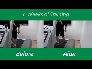 The BalanceTutor 4D Perturbation Treadmill: Falls Prevention Case Study