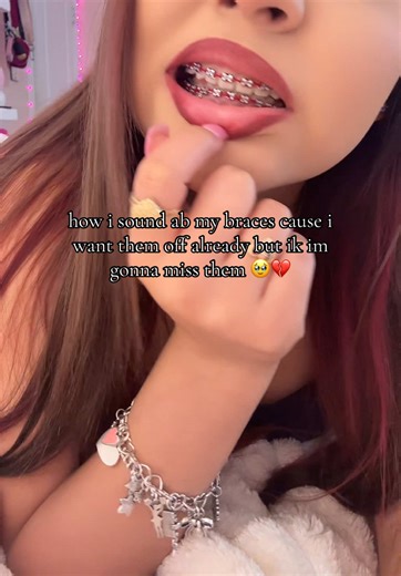 was supposed to get them off this month but i never wore my rubber bands 😭💔 #fypシ #braces #relatable