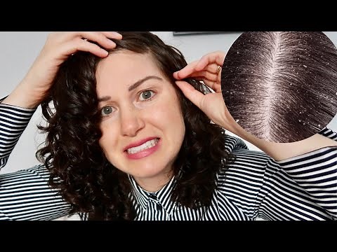 Dry Scalp, Product Buildup & Dandruff | simple treatment & prevention