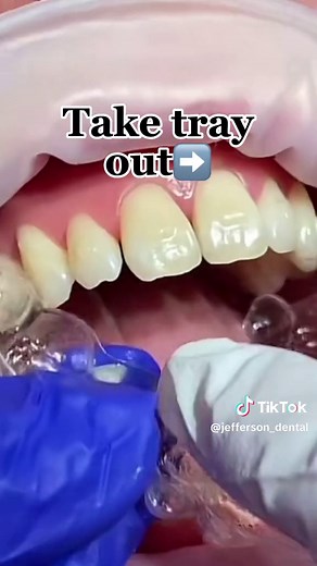 Jefferson Dental on TikTok
