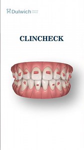 invisalign in london