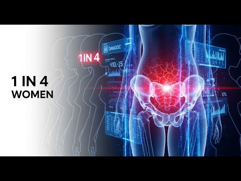 Chronic Pelvic Pain Explained: Causes, Diagnosis & Modern Treatment (Doctor Explains) - Your Guide