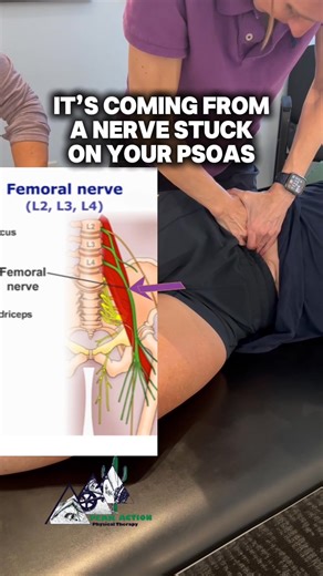 Did you know most chronic low back pain actually comes from your hip flexors (a.k.a. your PSOAS)? 🤯 There’s a nerve called the femoral nerve that runs right next to it — when this nerve gets glued down with adhesion, it can cause back pain, tightness, and weakness. ⚡️ This is how we free that nerve so your PSOAS can work properly again — taking pressure off your spine and giving you lasting, permanent back pain relief. 🙌💪 Comment “PAIN” if you’re tired of suffering and ready for real relief! 
