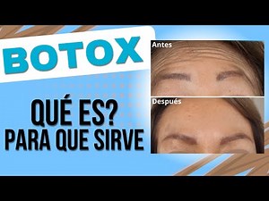 ¿Qué es el Botox y para qué sirve?