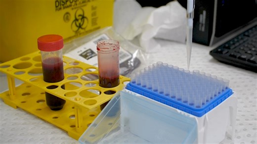 Venom gel: How deadly snakes could soon save lives and heal wounds