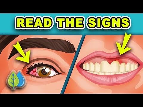 20 Signs of Vitamin Deficiency You Need to Know | Symptoms of Nutrients Deficiency