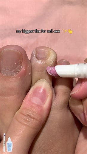 Clean Feet Therapy: Remove Dead Skin for Happy Soles