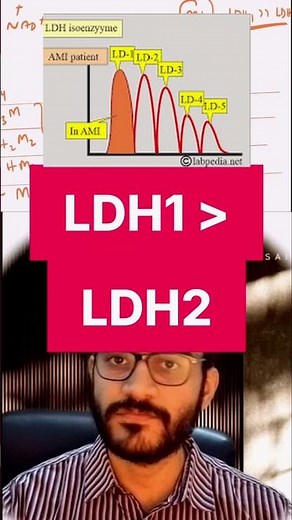 LDH Isoenzymes Explained: The "LDH Flip" in Myocardial Infarction 🫀 #biochemistry #ldh #MI