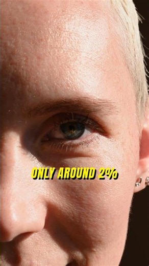 The Rarest Eye Color On Earth!