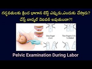 vaginal examination during pregnancy | labor and delivery ‪@momgeethastips‬