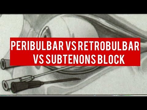 OCULAR ANAESTHESIA || peribulbar block, retrobulbar block and subtenons block