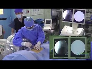 Stem Cell Treatment Degenerative, Bulging or Herniated Discs Stop Back Pain