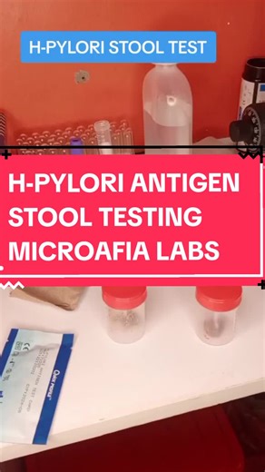 Exploring H. pylori Stool Test Process: A Comprehensive Guide