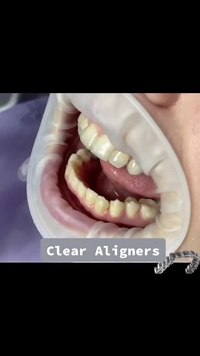 Dental_place_Rocket on TikTok